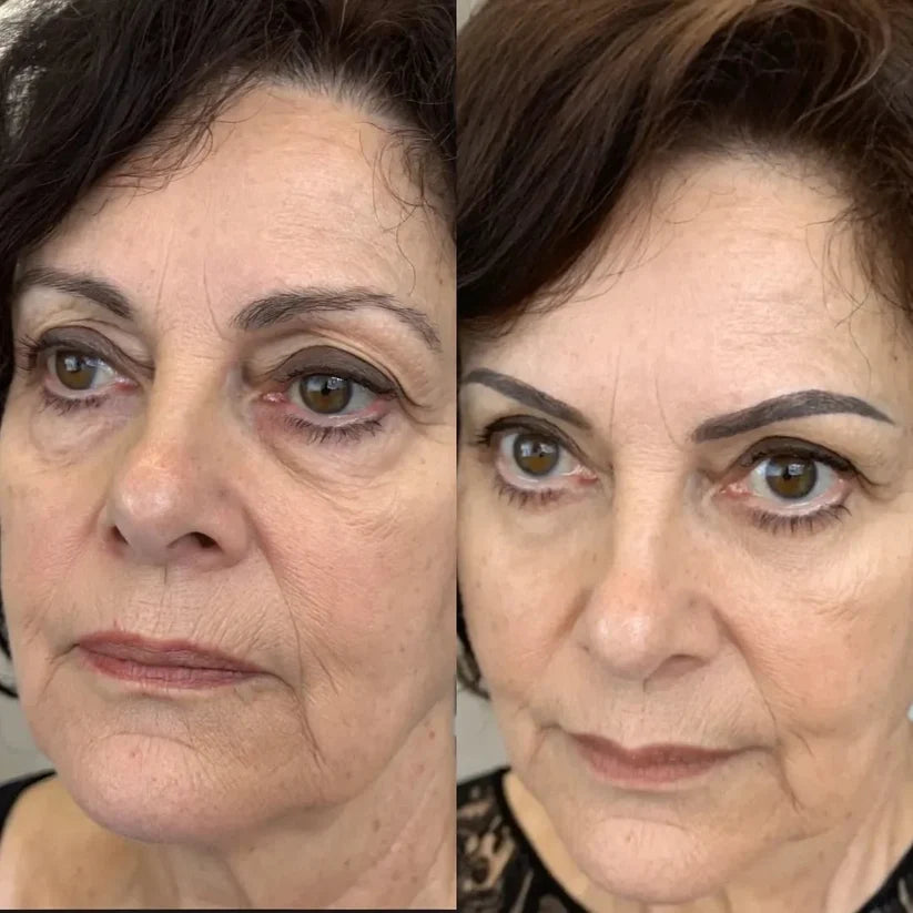 Solava  2-in-1 Red Light Therapy + EMS To Erase Eye Bags