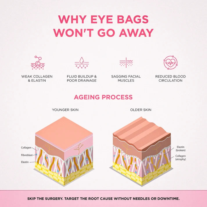 Solava  2-in-1 Red Light Therapy + EMS To Erase Eye Bags