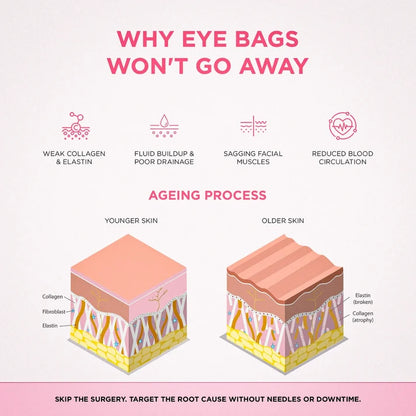 Solava  2-in-1 Red Light Therapy + EMS To Erase Eye Bags