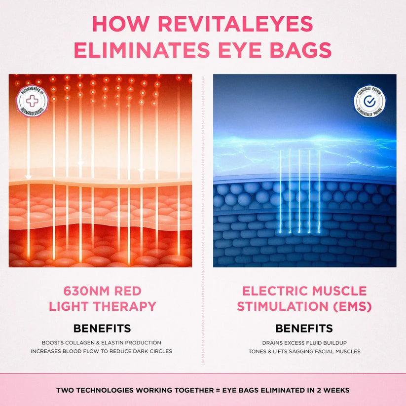 Solava  2-in-1 Red Light Therapy + EMS To Erase Eye Bags